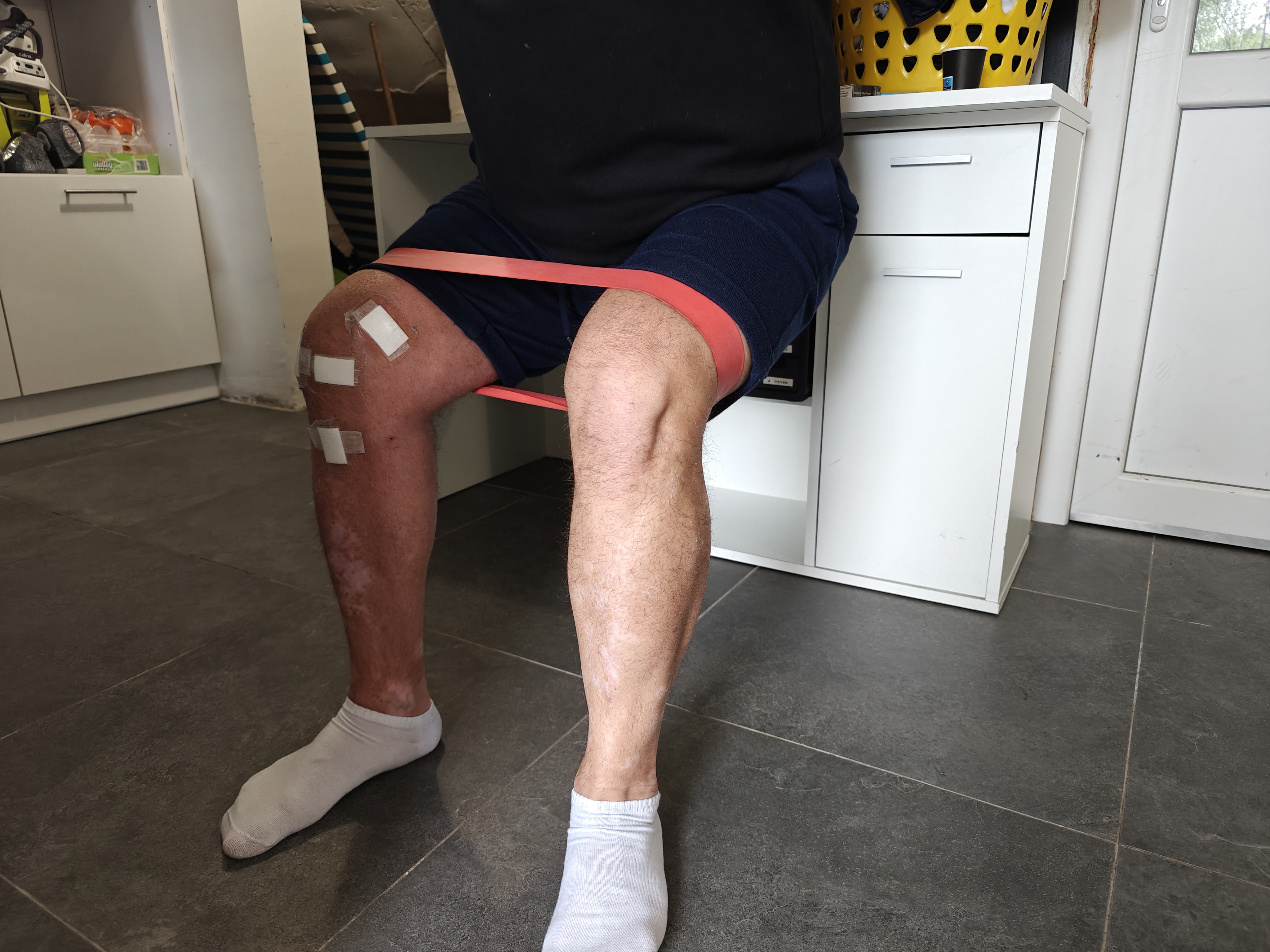 Orthopedische kinesitherapie behandeling